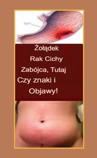 10 objawy Rak żołądka – cichy zabójca, którego nie wolno lekceważyć