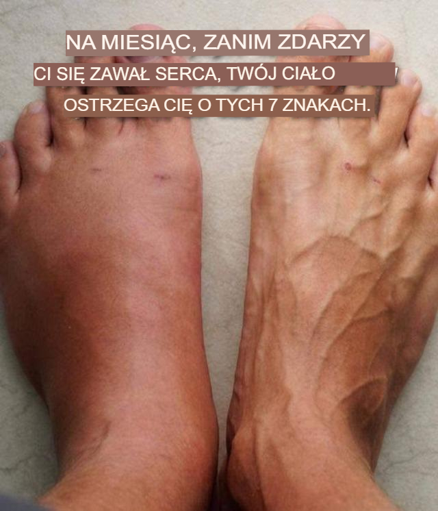 ⚠️ Na miesiąc przed zawałem serca Twoje ciało może wysyłać te 7 sygnałów ostrzegawczych