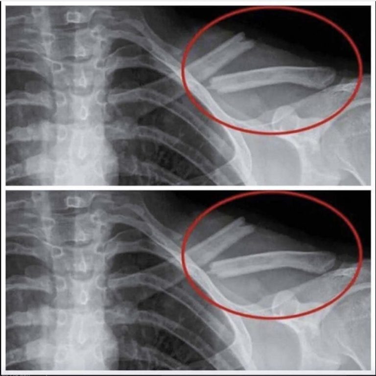 8 rzeczy, które dzieją się z Twoim ciałem, gdy przestajesz pić napoje dietetyczne