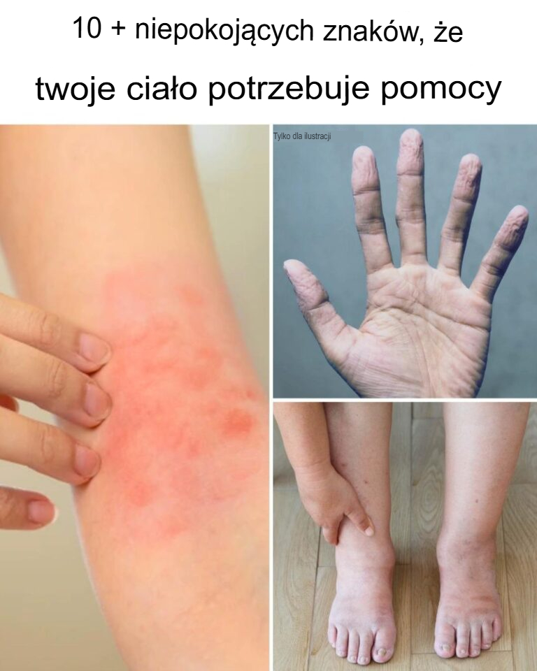 10+ ostrzegawczych sygnałów, że twoje ciało potrzebuje pomocy
