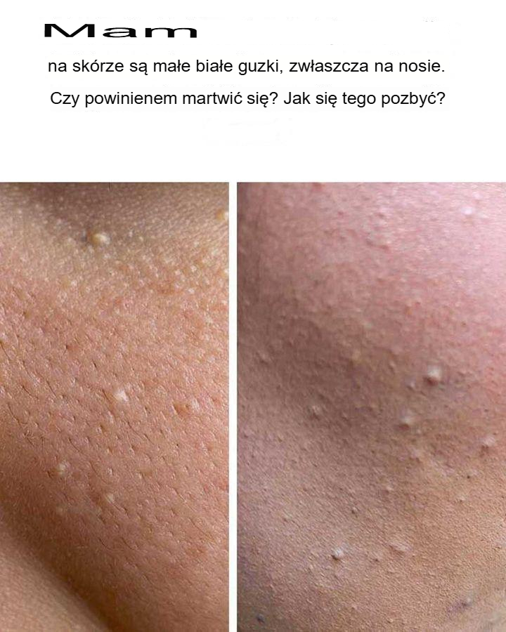 To mnie naprawdę wkurza!