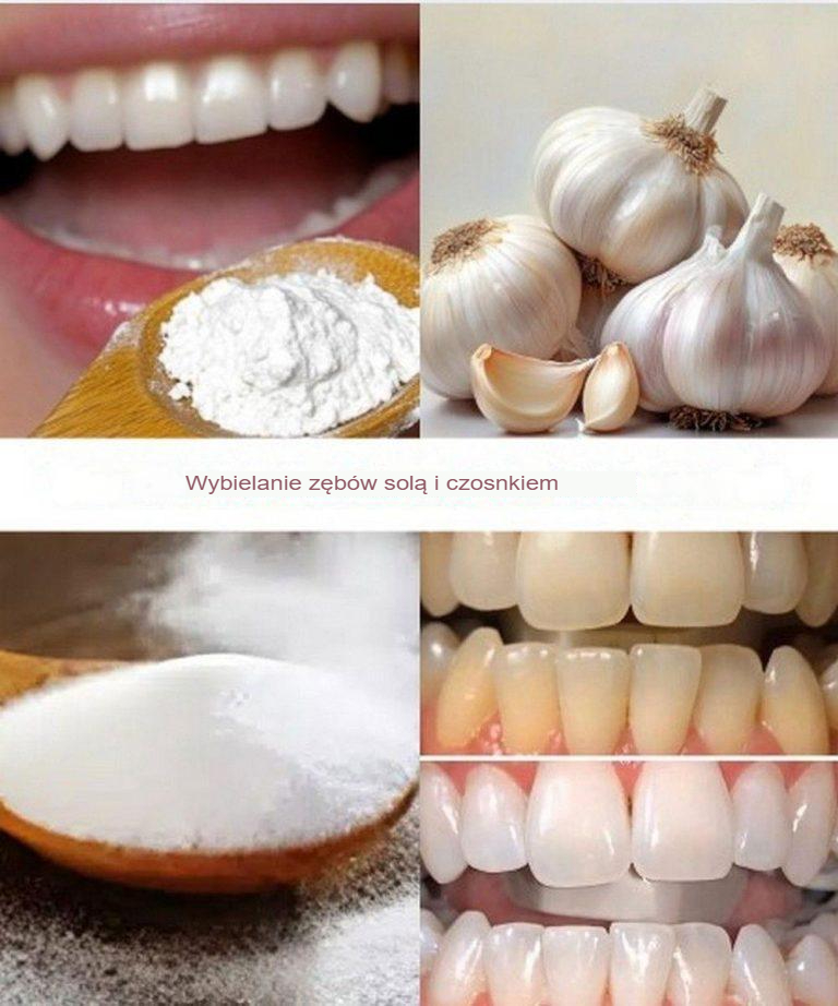 Jak wybielić zęby solą i czosnkiem?