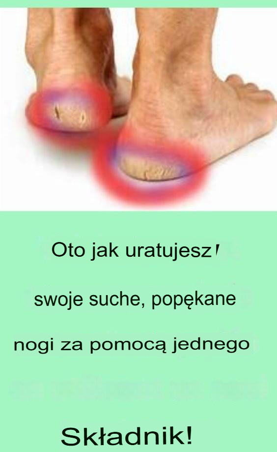 Jak uratować suche, popękane stopy za pomocą tylko jednego składnika!