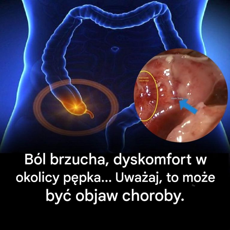 Tępy ból brzucha, ból brzucha w okolicy pępka? Oto, co musisz wiedzieć