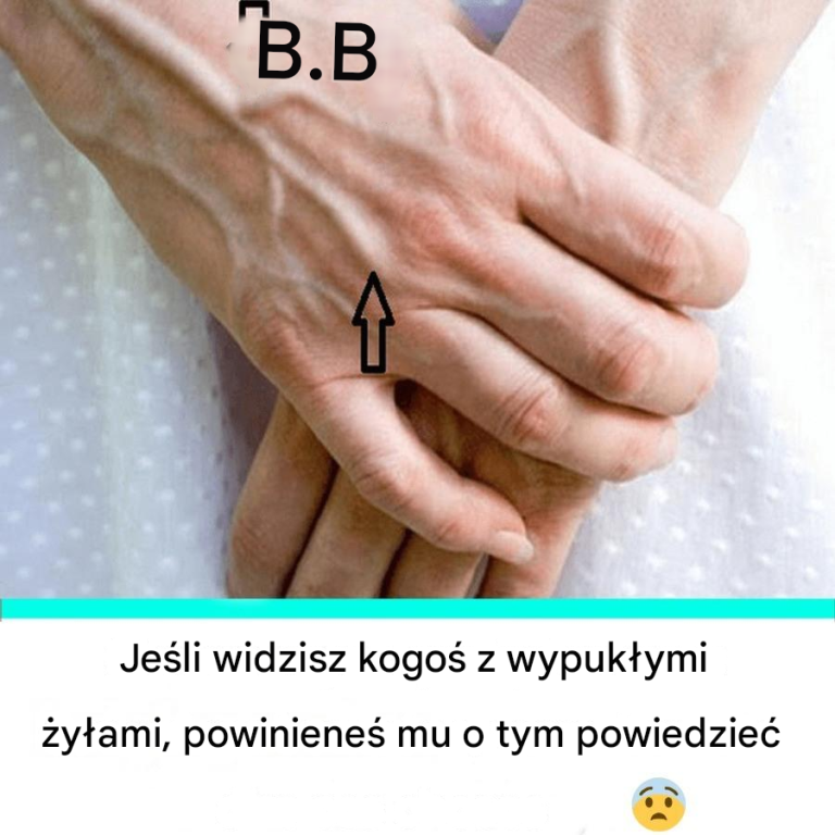 Osoba z wypukłymi żyłami