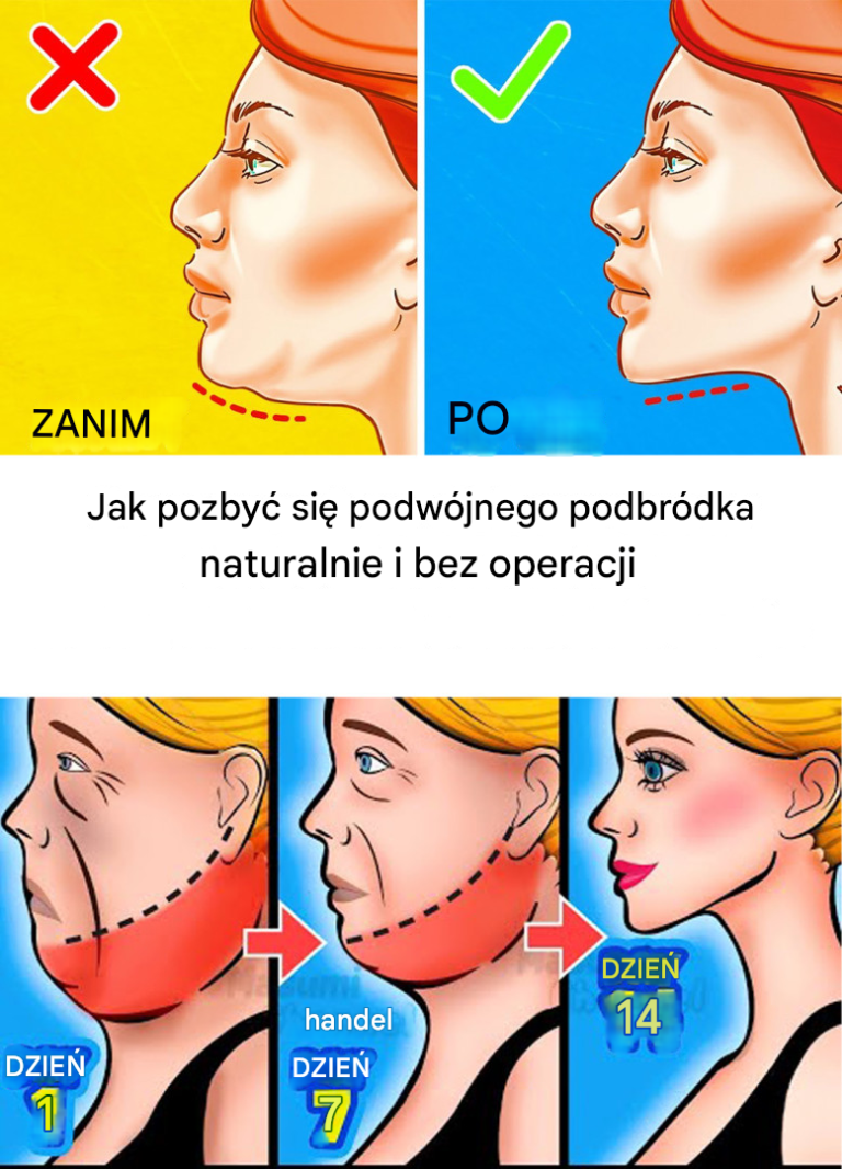 Jak pozbyć się podwójnego podbródka?