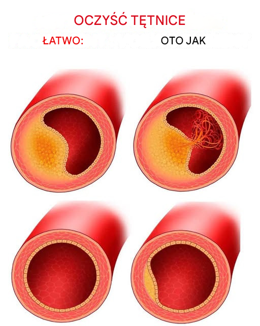 10 produktów, które powinieneś jeść codziennie, aby zachować zdrowe tętnice