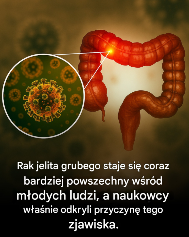 Naukowcy zidentyfikowali prawdopodobną przyczynę raka jelita grubego u młodych ludzi
