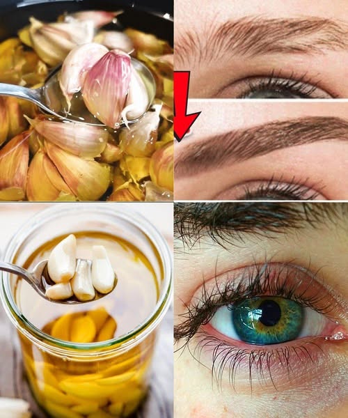 Pożegnaj się z rzadkimi brwiami i krótkimi rzęsami dzięki czosnkowi