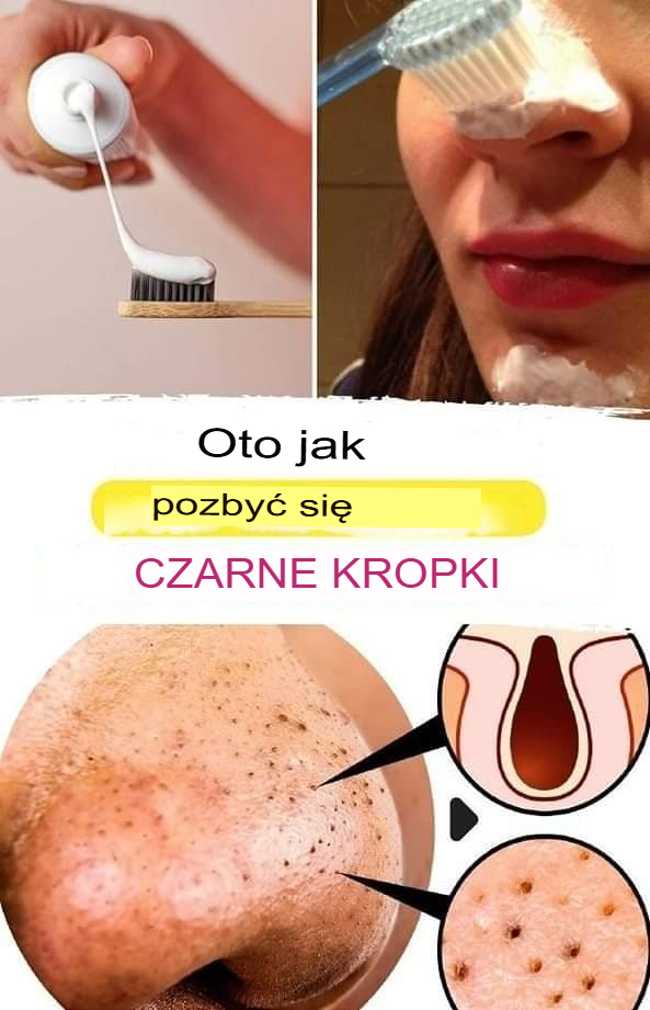 Jak usunąć zaskórniki z twarzy za pomocą szczoteczki do zębów?