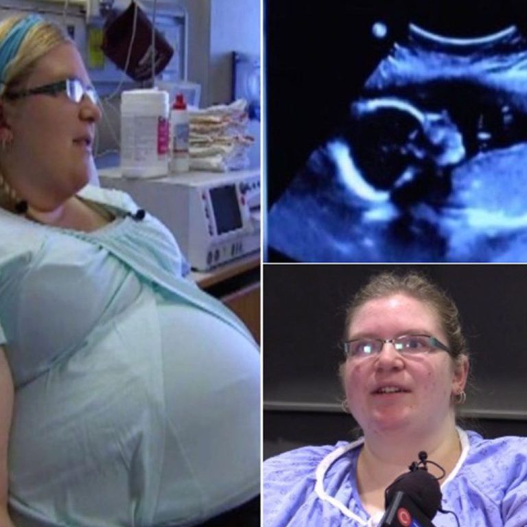 Para była w drodze na badanie fizjologiczne – wtedy pielęgniarka wyjaśniła, że ​​to przypadek ponad 15 milionów
