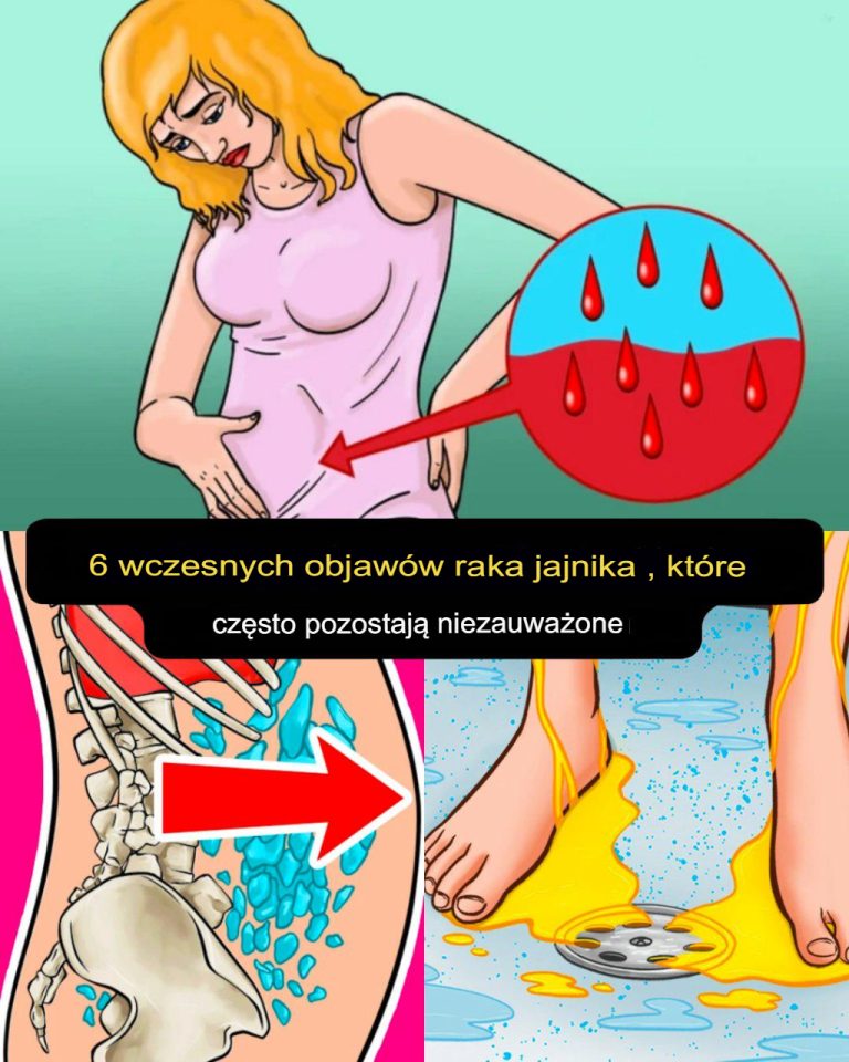 6 często pomijanych objawów raka jajnika