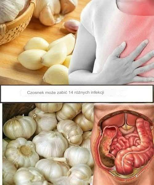 Czosnek może zabić 14 różnych infekcji, o tym pewnie nie wiedziałeś.