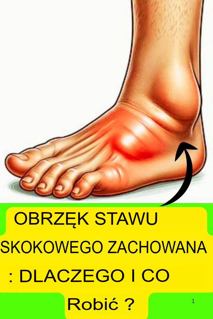 Obrzęk kostki nie ustępuje: dlaczego i co robić?
