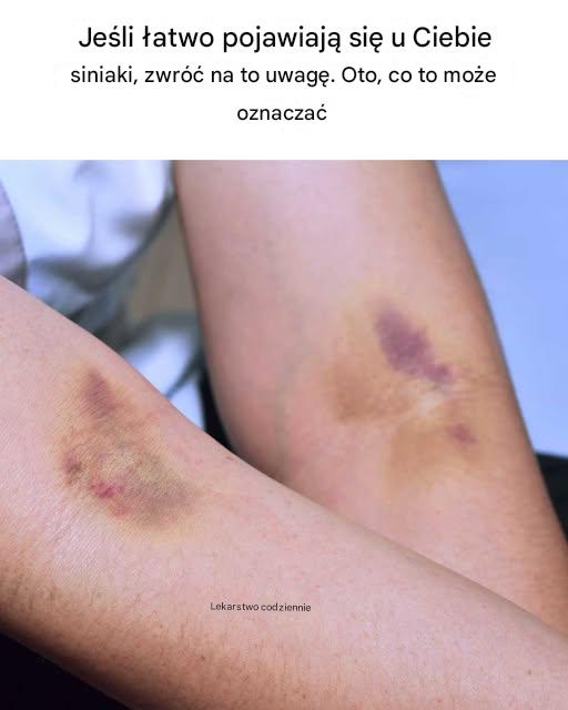 To zupełnie nowa informacja