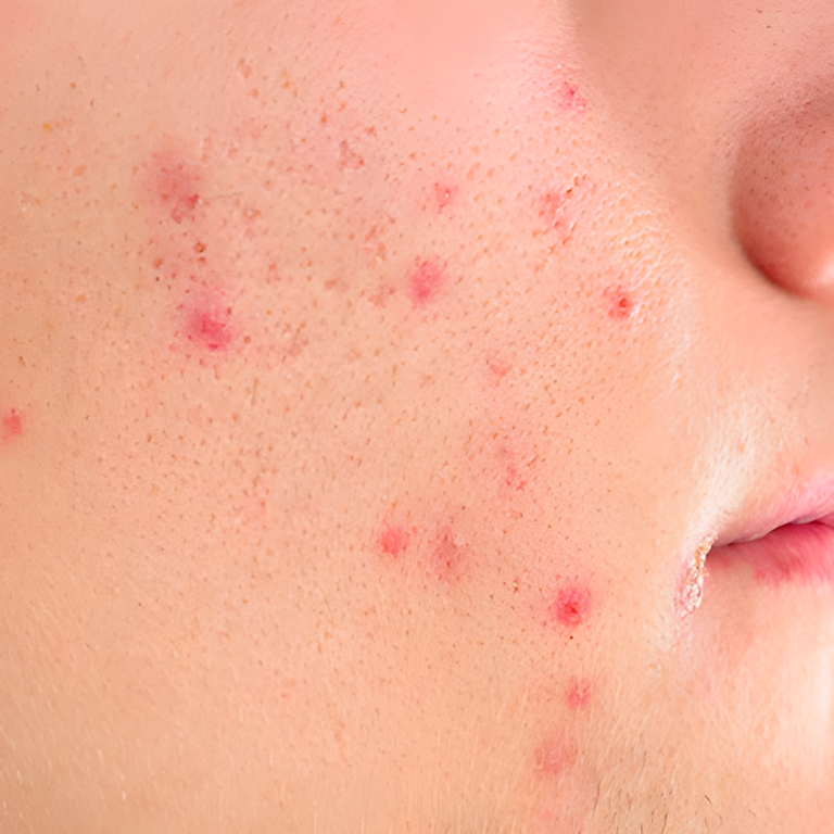 Co oznaczają te czerwone kropki na skórze?