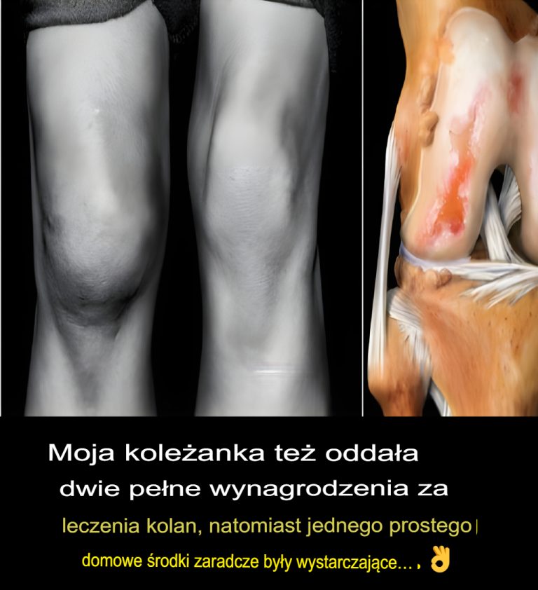 🦵 Naturalne i skuteczne domowe sposoby na ból kolana – bez drogich zabiegów
