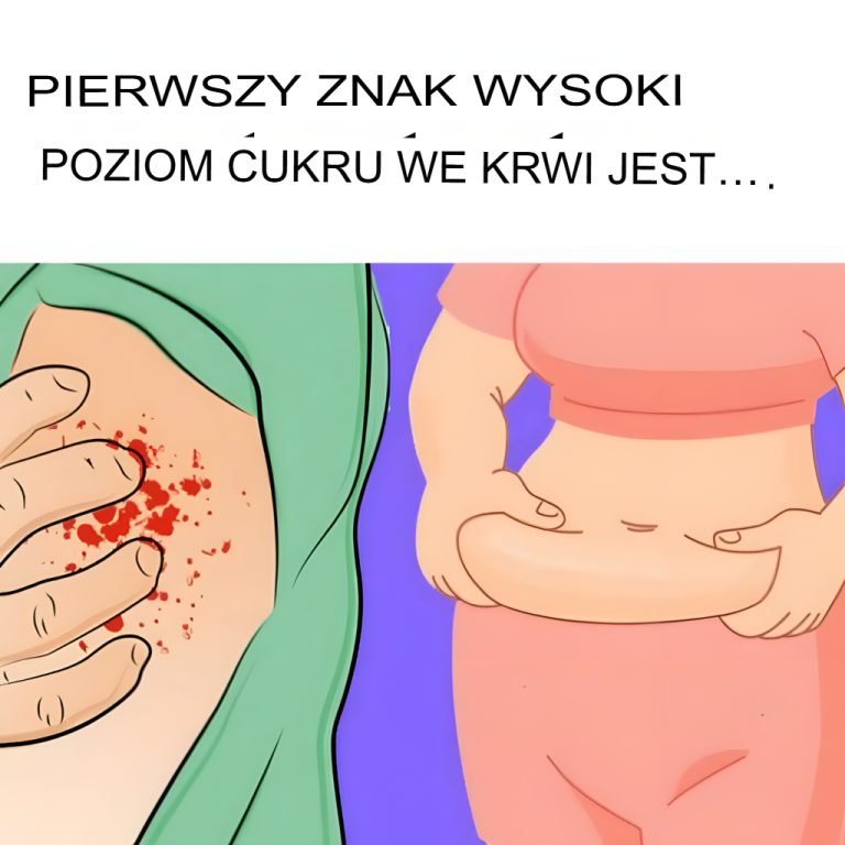 13 ostrzegawczych oznak wysokiego poziomu cukru we krwi i 9 sposobów na przejęcie kontroli nad swoim zdrowiem