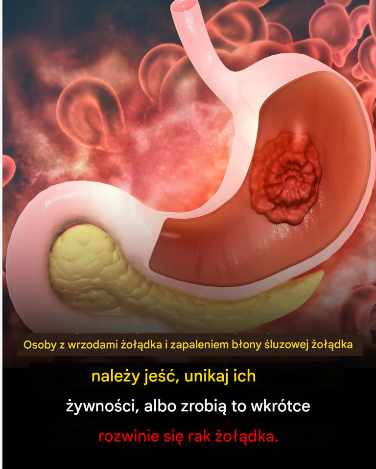 Jaka jest idealna dieta w przypadku wrzodów żołądka i zapalenia błony śluzowej żołądka?