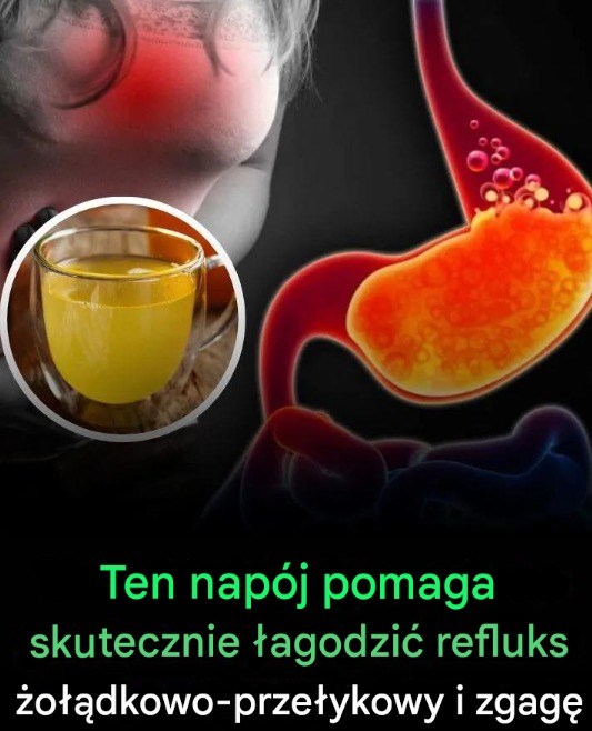 Naturalny napój łagodzący refluks i zgagę – ukojenie dla żołądka w jednej szklance