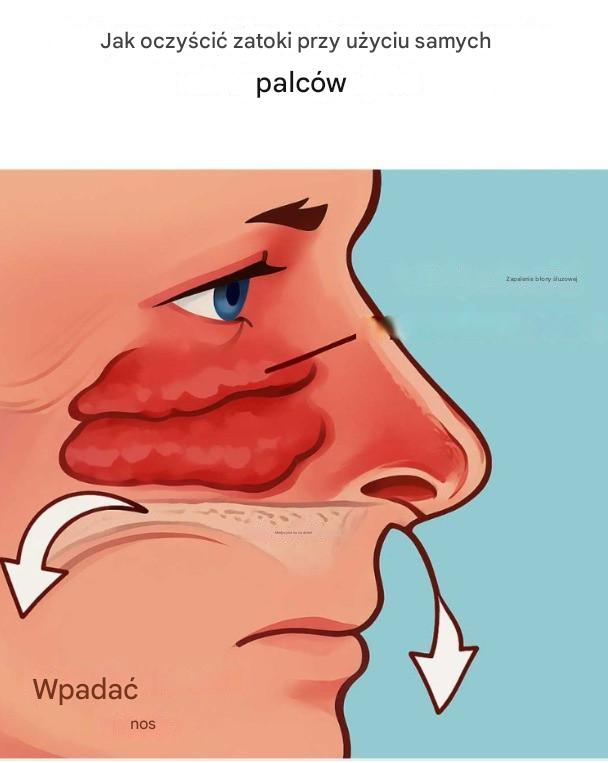 Jak udrożnić zatoki tylko palcami? Naturalna metoda na ulgę i oczyszczenie!