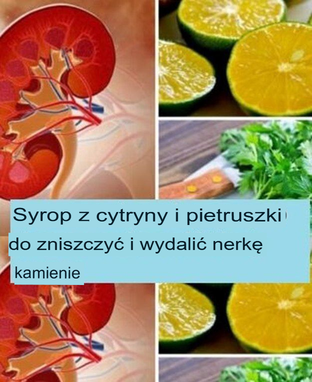 Syrop cytrynowo-pietruszkowy na kamienie nerkowe