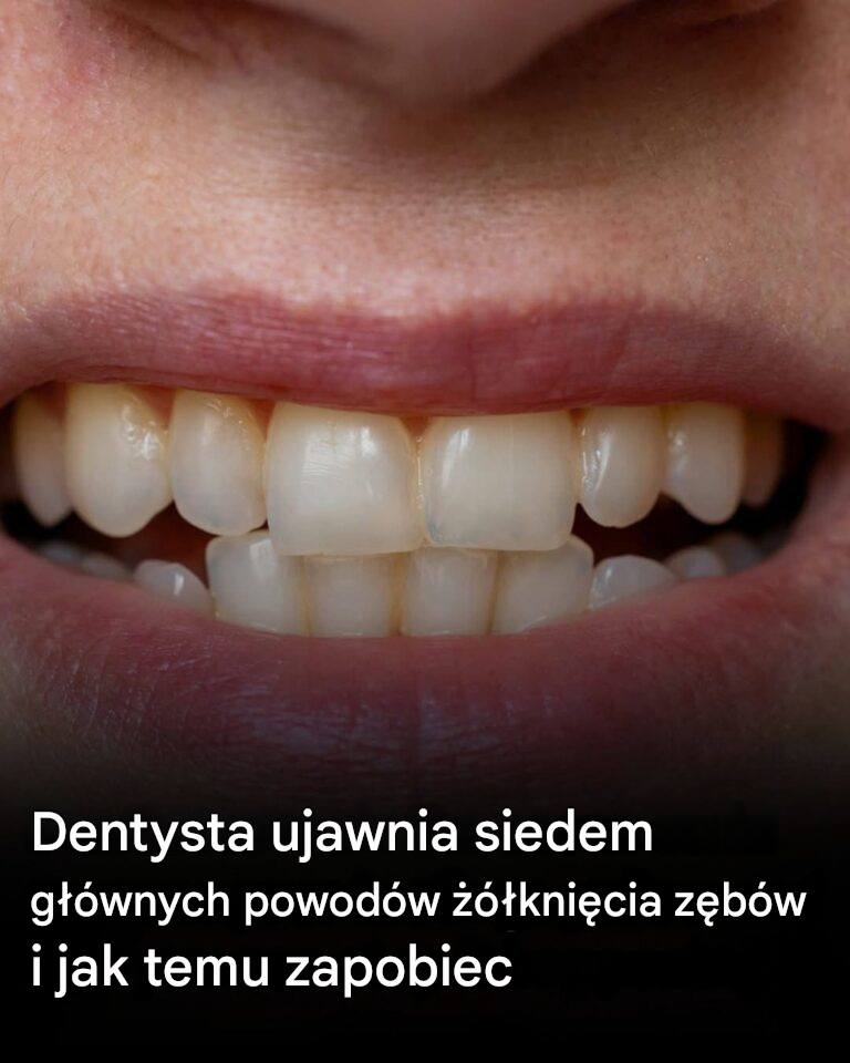 Dentysta wyjaśnia 7 głównych przyczyn żółknięcia zębów i jak temu zapobiegać