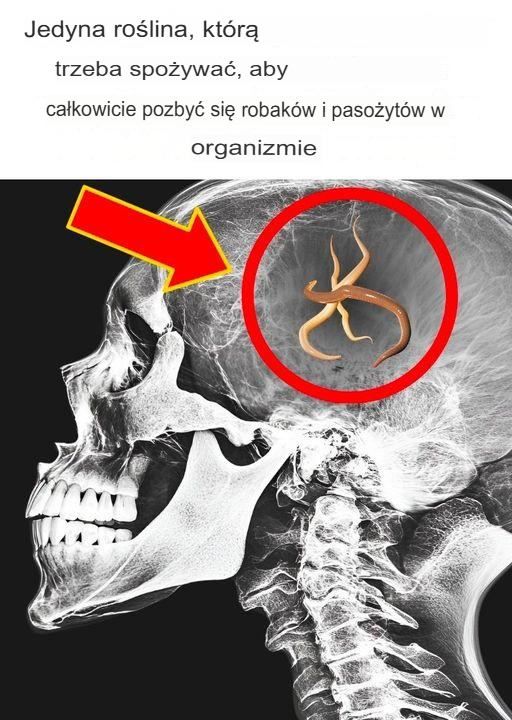 Tylko 2 kulki… Wydala wszystkie robaki i pasożyty z twojego ciała. Leczenie