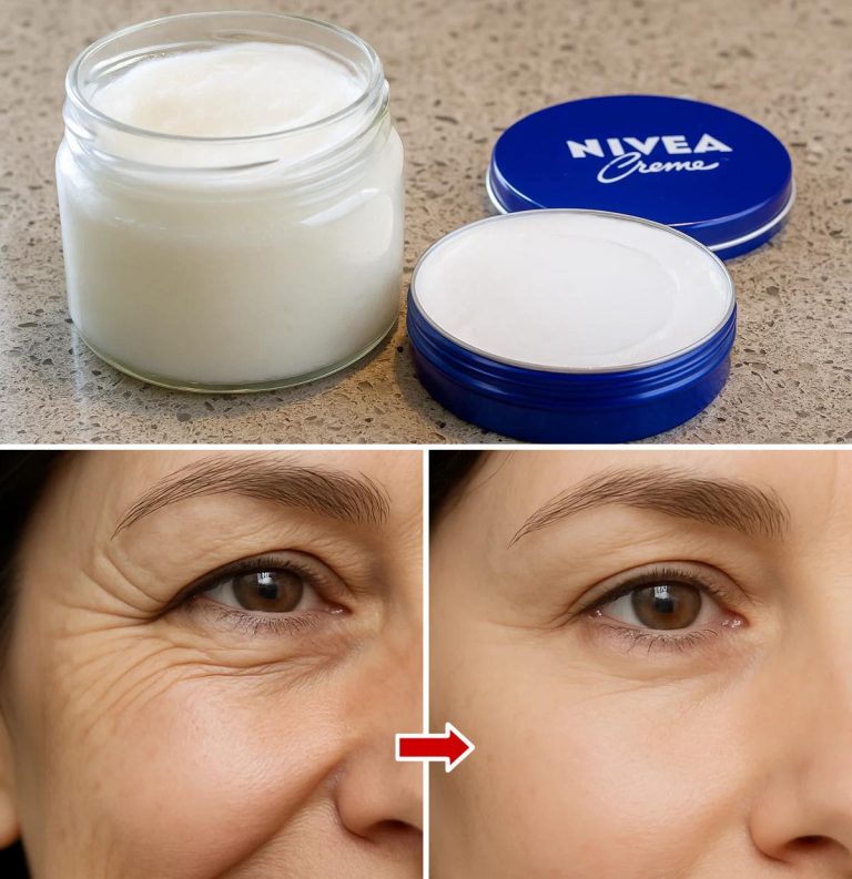 Jak połączyć olej kokosowy i krem Nivea, aby wyeliminować zmarszczki i linie mimiczne