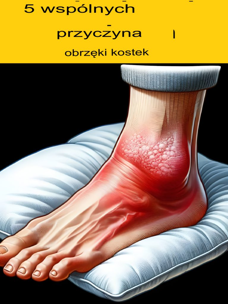 5 najczęstszych przyczyn obrzęku kostek