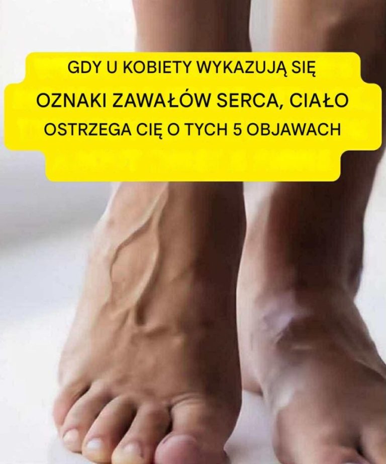 5 objawów u kobiet, które wskazują na zbliżający się atak serca