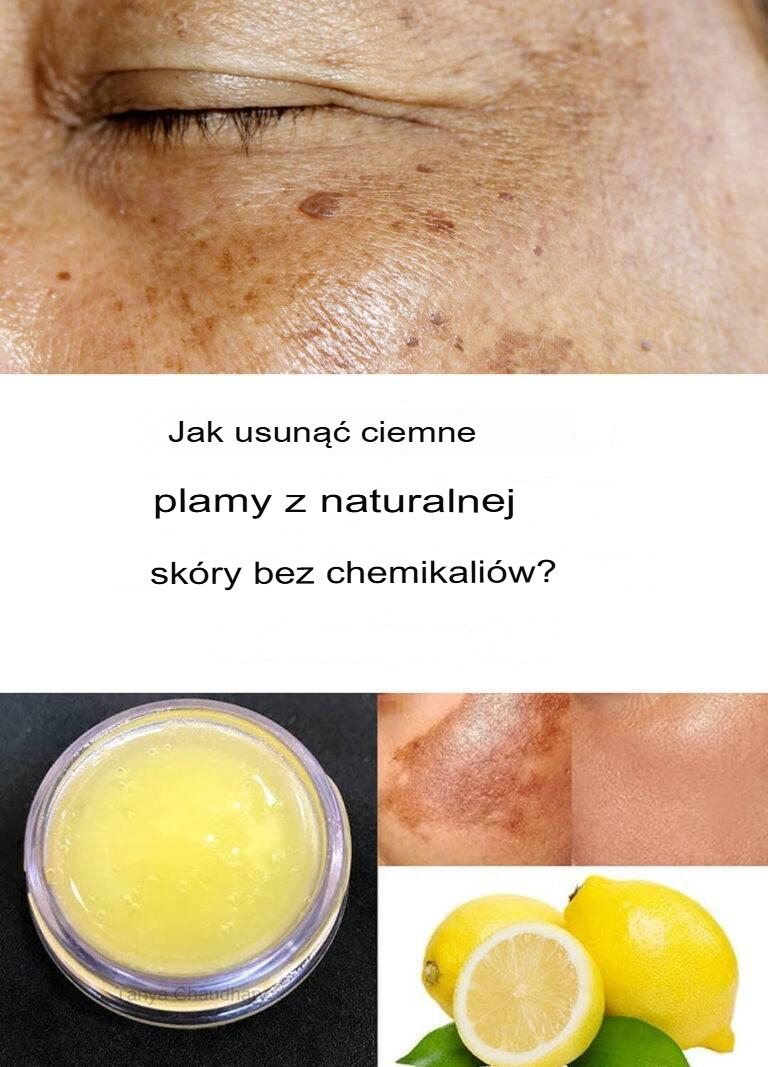 Jak pozbyć się ciemnych plam przy pomocy naturalnych środków?