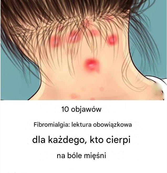 10 objawów fibromialgii, które powinien przeczytać każdy, kto cierpi na bóle mięśni