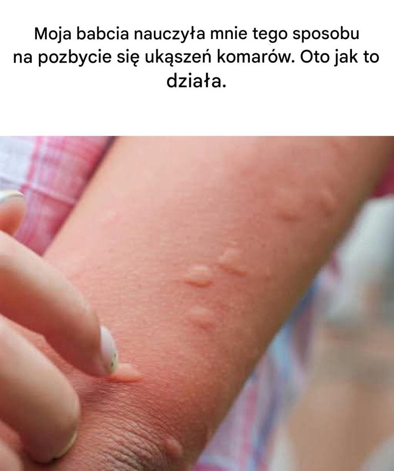 Oparzyć się, żeby przestać się drapać? Prawda o używaniu gorącej łyżki do leczenia ugryzień