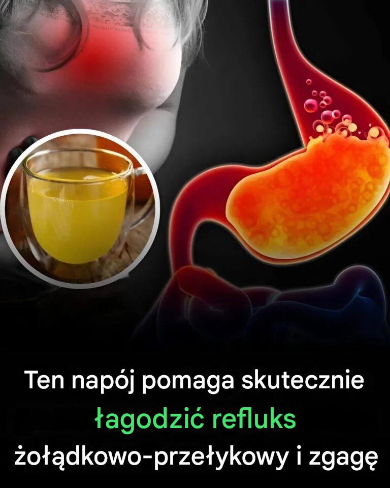 Ten napój pomaga skutecznie łagodzić refluks żołądkowo-przełykowy i zgagę