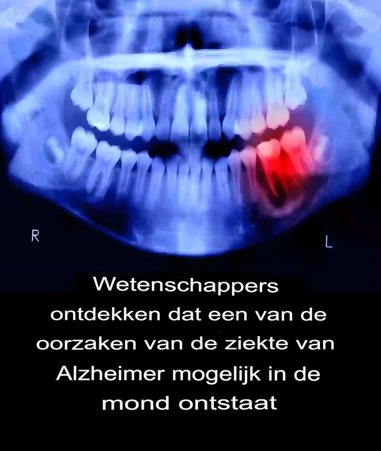 Naukowcy odkryli, że jedną z przyczyn choroby Alzheimera może być jama ustna