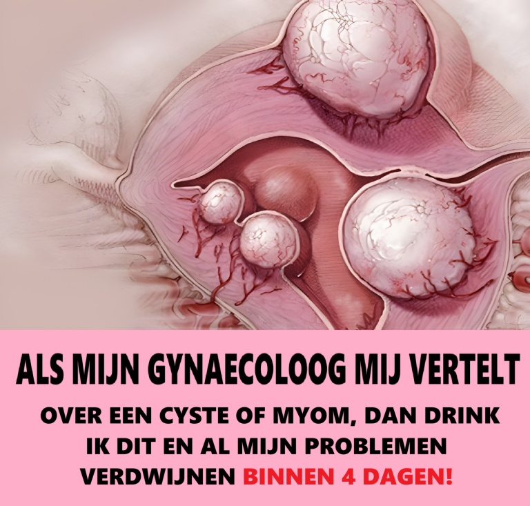 Jeżeli mój ginekolog stwierdzi, że mam torbiel lub guz w macicy, wypiję ten napój, a wszystkie moje problemy znikną w ciągu 4 dni!