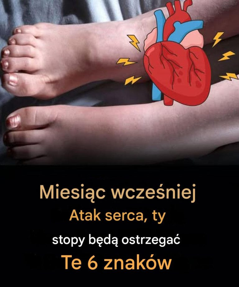 Miesiąc przed zawałem serca Twoje stopy ostrzegają Cię przed tymi 6 objawami