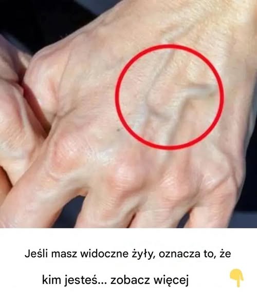 Kiedy należy martwić się żyłami, które pojawiają się znikąd