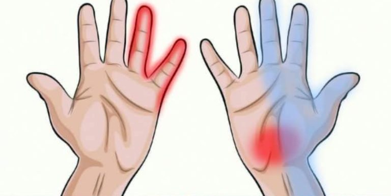 7 rzeczy, które Twoje dłonie mogą Ci powiedzieć o Twoim zdrowiu