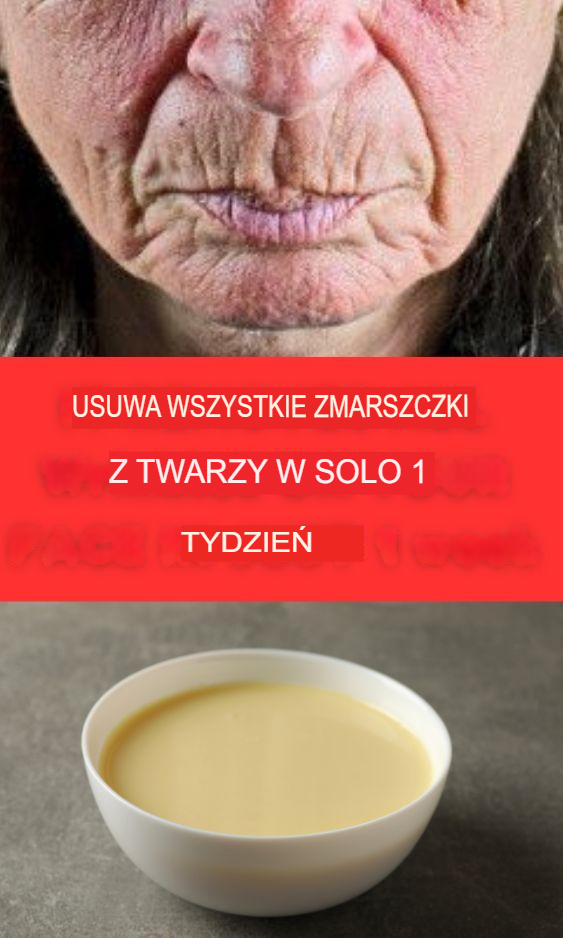 Dzięki temu kremowi pozbyłam się zmarszczek na twarzy