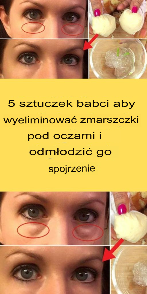 5 babcinych sztuczek na pozbycie się zmarszczek pod oczami i odmłodzenie wyglądu – domowe triki