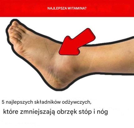 5 najlepszych składników odżywczych, które zmniejszają obrzęk stóp i nóg