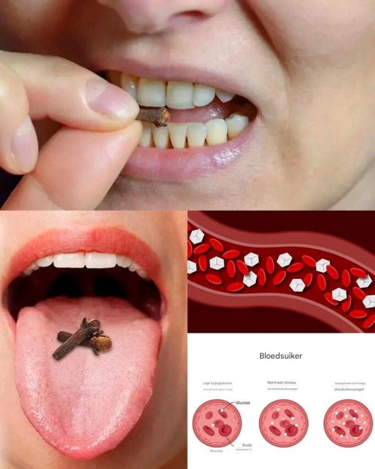 Codzienne żucie goździków: drobny nawyk o dużych korzyściach zdrowotnych.