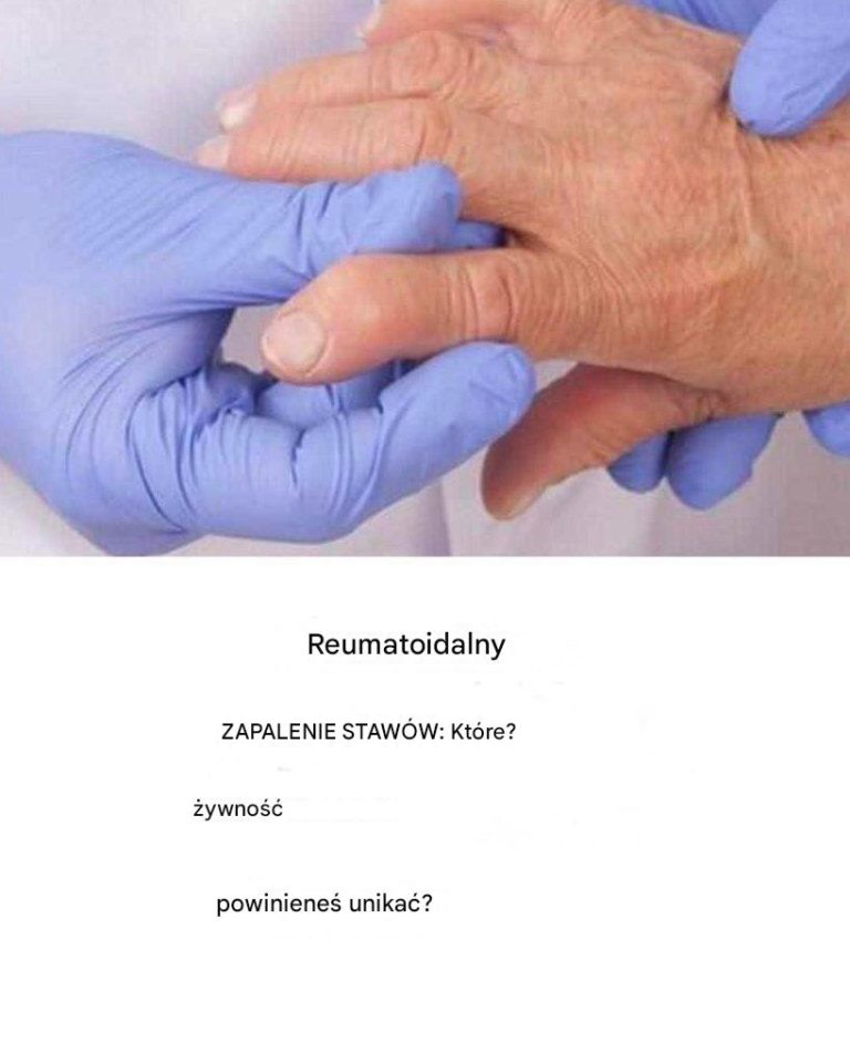 Życie z reumatoidalnym zapaleniem stawów: codzienne wyzwania