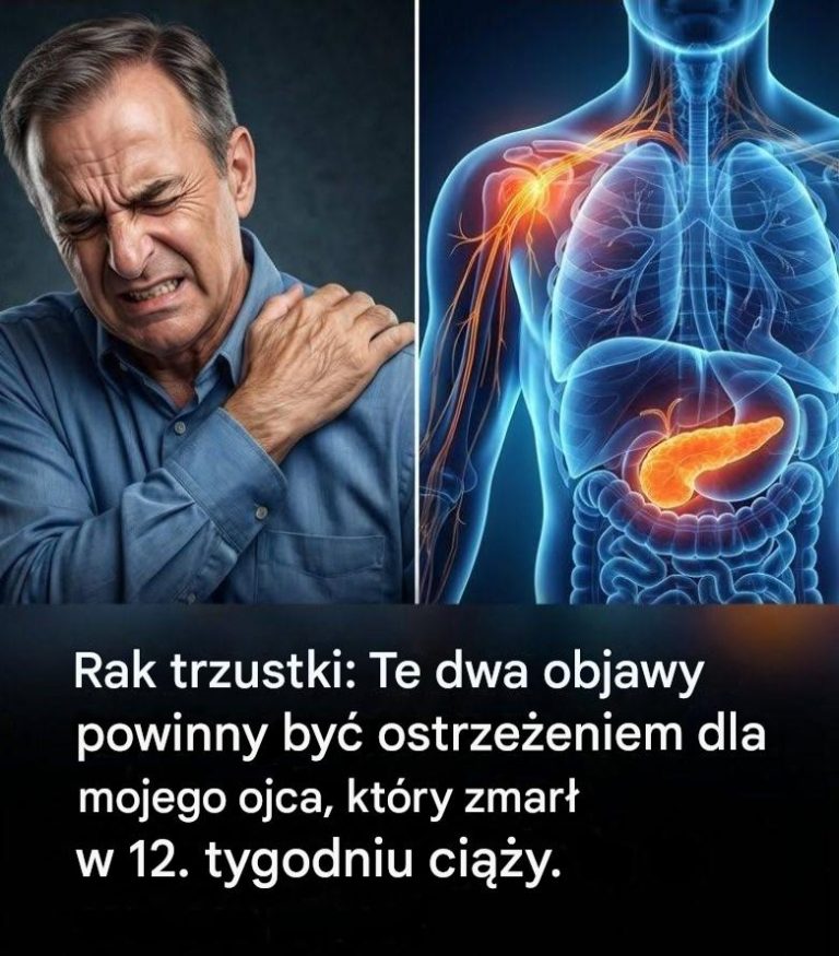 Rak trzustki: 10 objawów, które mogą pomóc we wczesnym wykryciu (nie ignoruj ​​ich)