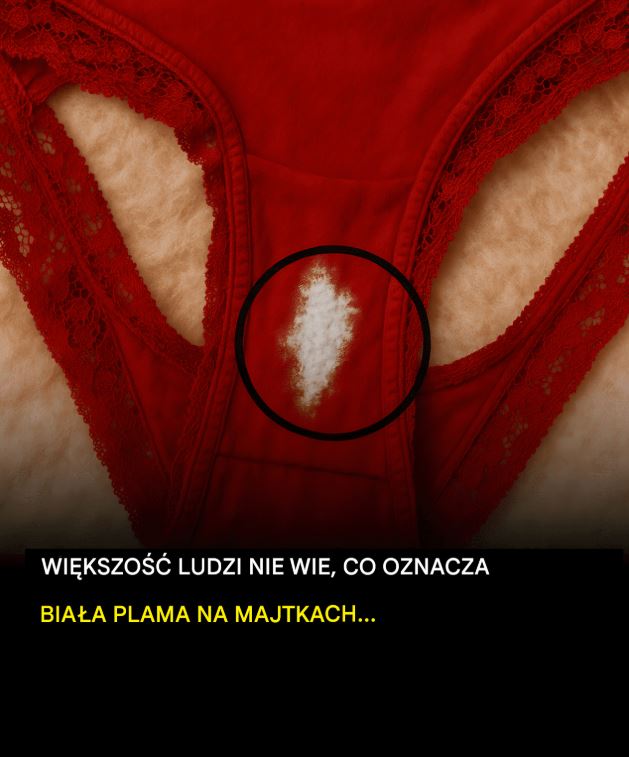 Plamy przypominające wybielacz na bieliźnie: co to oznacza?